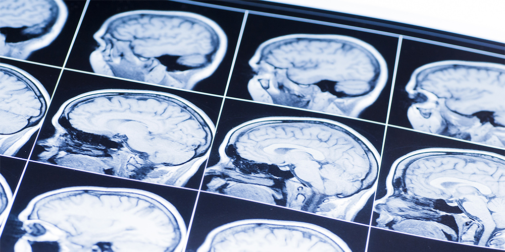 Neurology