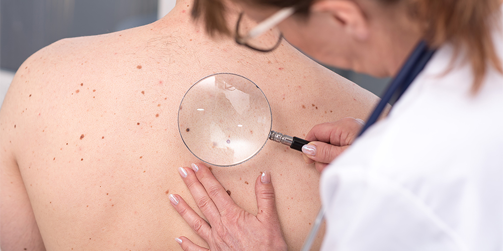 Dermatology